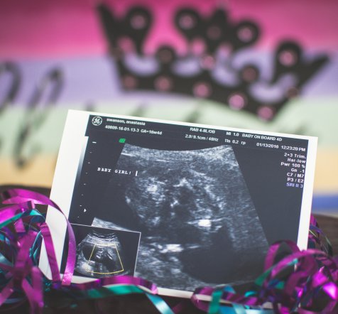 Gender Reveal Photography